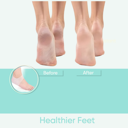 Insoole Heel Wrap™